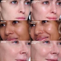 Peter Thomas Roth Collagen Skinjection™ Plumping & Firming Serum 30ml