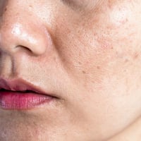 RVB LAB Meso Fill Micro-Peel Tri-Ácido Exfoliante e Iluminador 50ml
