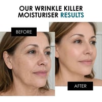 skinChemists Wrinkle Killer Day Moisturizer 50ml