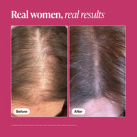 Viviscal Healthy Hair Vitamins Supplement Tablets Hair Loss x60