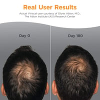 Viviscal Man Comprimidos Suplemento Vitaminas para un Cabello Sano Caída del Cabello x180