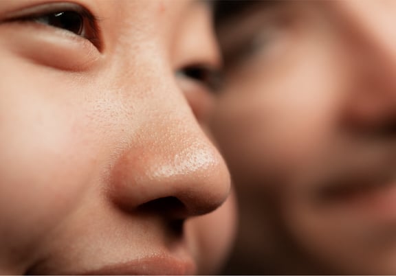 This is Why You Have “Large” Pores