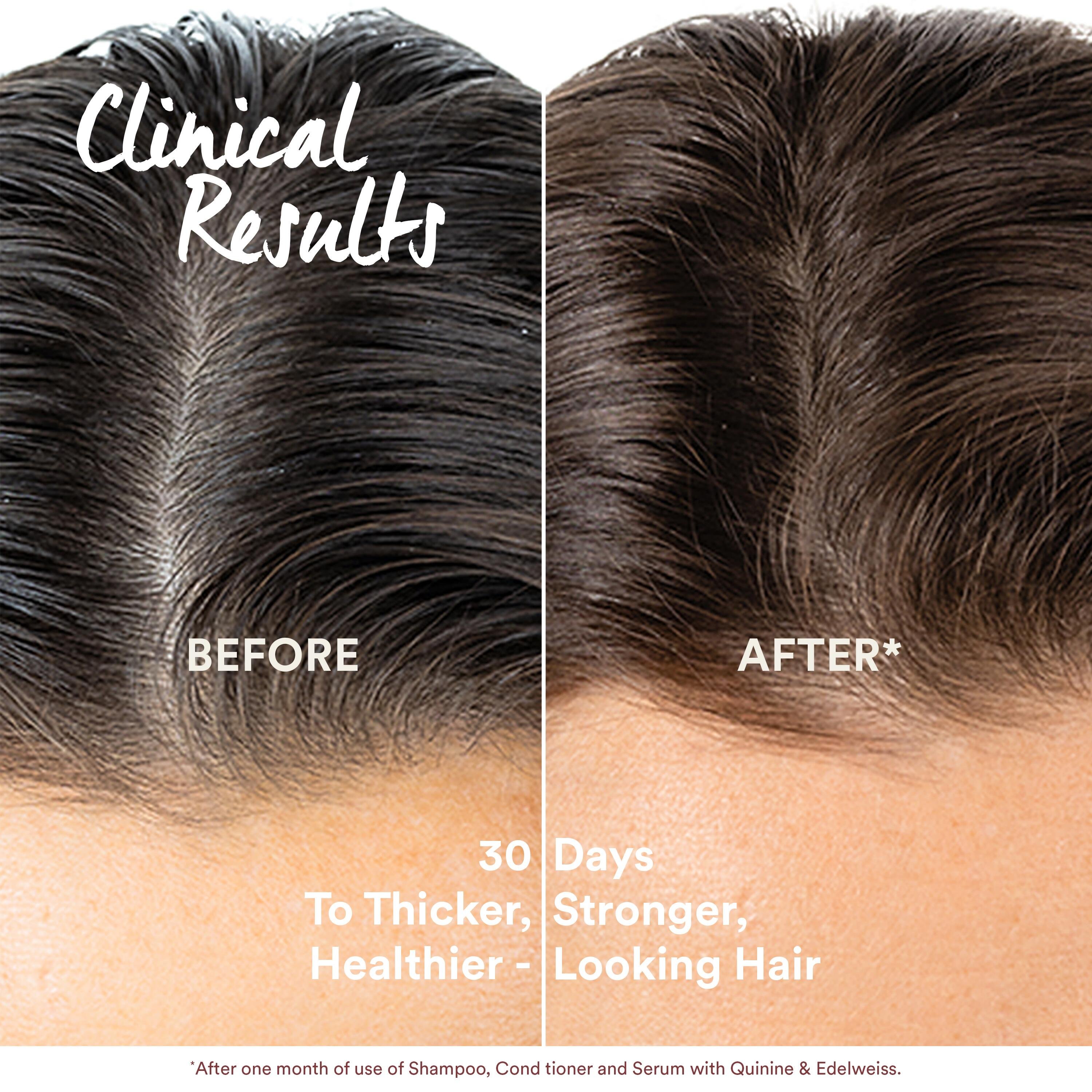 Klorane Anti-Hair Loss Serum 100ml (3.38floz)